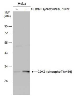 Western Blot: CDK2 [p Thr160] Antibody [NBP3-13301]